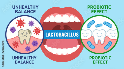 Probiotic Bacteria Oral Health Lactobacillus Effect