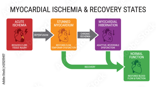 Cuadro en lienzo Myocardial Hibernation Stunned Myocardium Ischemia Recovery Diagram