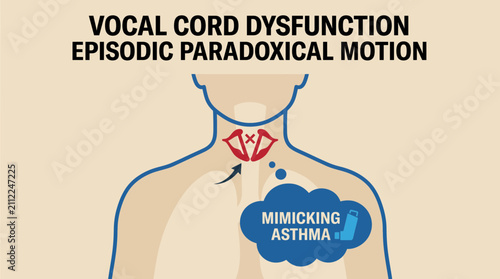 Photography Vocal Cord Dysfunction Episodic Paradoxical Motion Mimicking Asthma