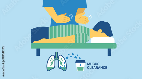 Quadro su tela Chest Physiotherapy Percussion Technique for Mucus Clearance