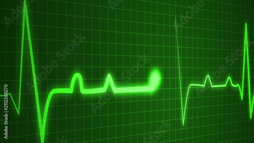 Health heartbeat line showing heart rhythm and medical monitor trace animation