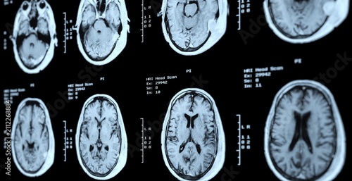 Fotografie Medical scans show brain cross-sections in grayscale