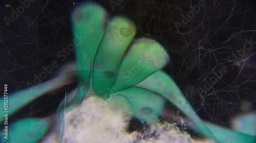 Group of trumpet-shaped Stentor coeruleus ciliates attached to a substrate, microscopic darkfield view at 100x magnification