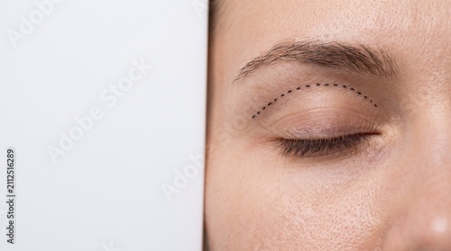 Close up of woman eye with surgical dashed line marks for eyelid correction procedure.