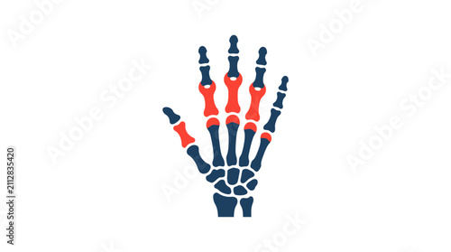 Bild auf Leinwand Hand Skeleton Anatomy Icon - Arthritis and Joint Pain Illustration
