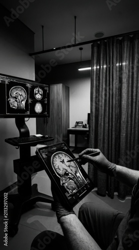 Medical Professional Analyzing Brain Scan Images With Stylus On Tablet And Monitor In Modern