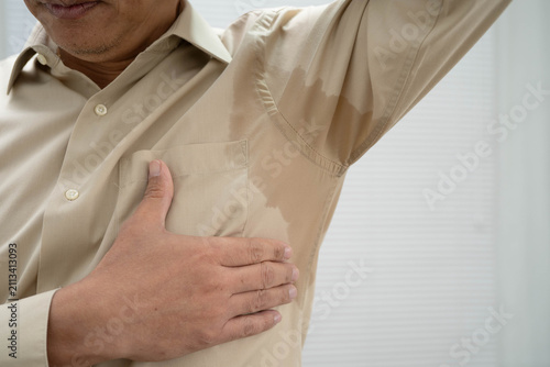 Man with sweaty arm pit on shirt when working in office, Hyperhidrosis sweating.