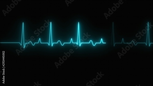 Quadro su tela Neon blue heart rate monitor line showing a pulse heartbeat on a dark background