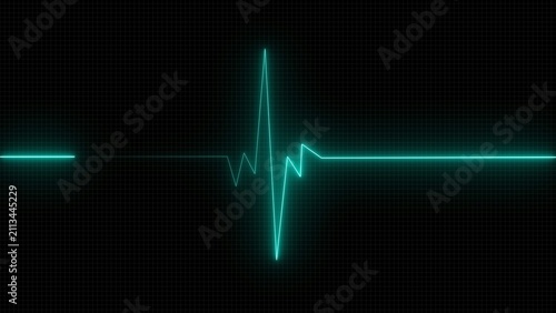 Fotografía Neon green heartbeat line showing a medical pulse rhythm isolated on a dark back