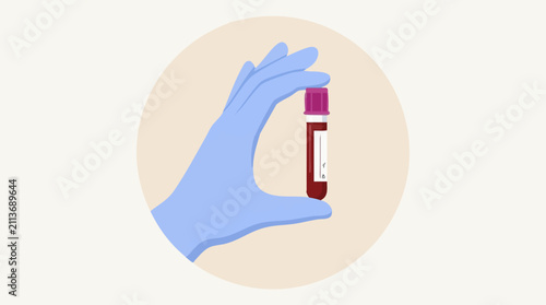 Quadro su tela Gloved hand holding a blood sample tube for medical testing and diagnosis