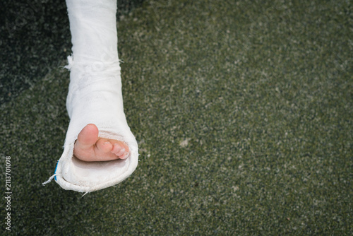 Foto Child's foot in white leg cast resting on green surface