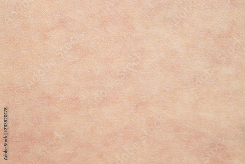 Принти на полотні Texture of normal skin as background, closeup