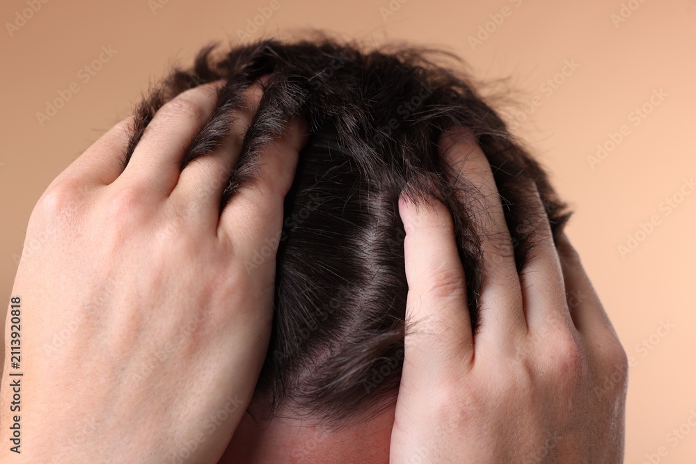 Fototapeta premium Man examining his head on beige background, closeup