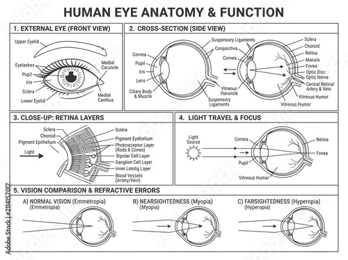 Educational diagram showing human eye anatomy, retinal layers, and common vision conditions.