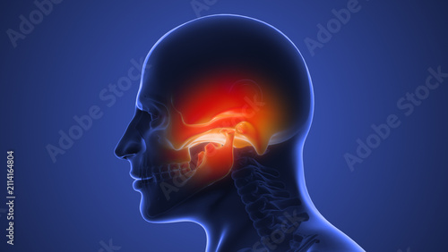 Facial Pain Caused by TMJ Dysfunction
