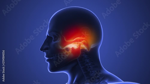 Facial Pain Caused by TMJ Dysfunction