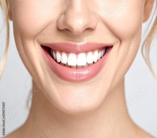 Close-up shot of a woman smiling brightly showing healthy white aligned teeth and lips.
