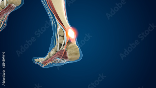 Inflamed Achilles Tendonitis illustration of a Human Leg 3d Illustration