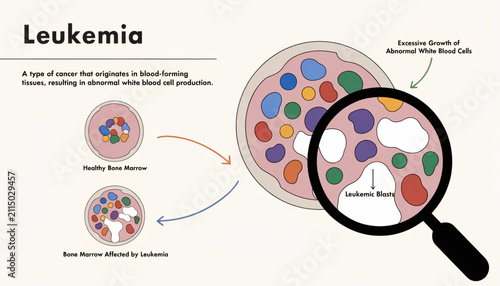 Leukemia