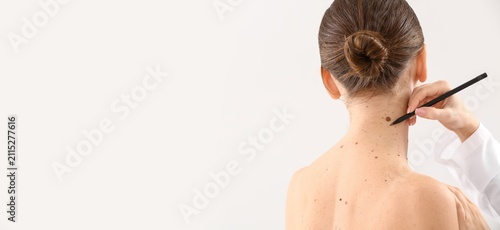 Dermatologist examining mol...