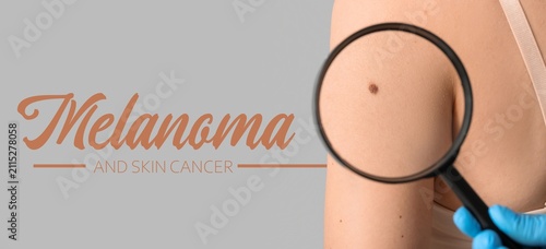Melanoma and skin cancer aw...