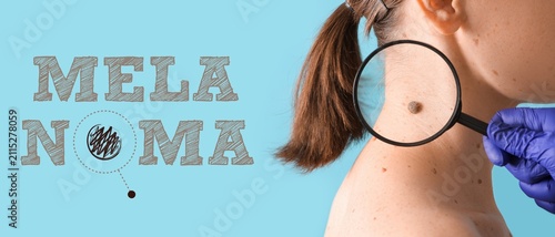 Melanoma skin cancer awaren...