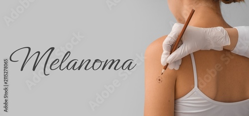 Melanoma skin cancer diagno...