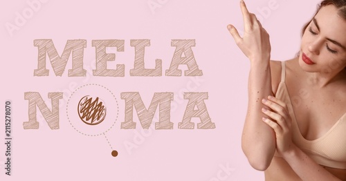 Melanoma skin cancer awaren...
