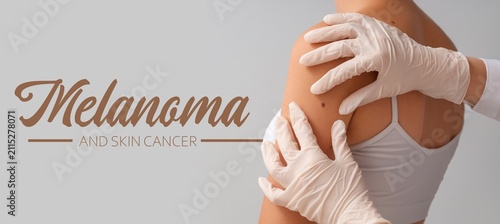 Dermatologist examining a p...