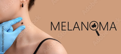 Dermatologist examining a m...
