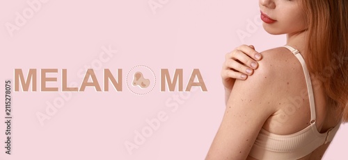 Melanoma skin cancer awaren...