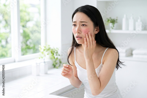 頬の赤み・赤ら顔・酒さなどの肌荒れを気にする若い日本人女性のスキンケアと敏感肌トラブルを表現した美容イメージ