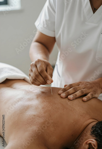 Acupuncture treatment on a ...