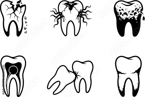 Black and white dental vector icons set showing tooth decay, cavities, root canal, broken tooth, and impacted wisdom teeth
