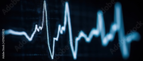 Close-up of Heartbeat Display on Monitor Showing Fluctuating Line in Hospital Room Medical Technology Concept