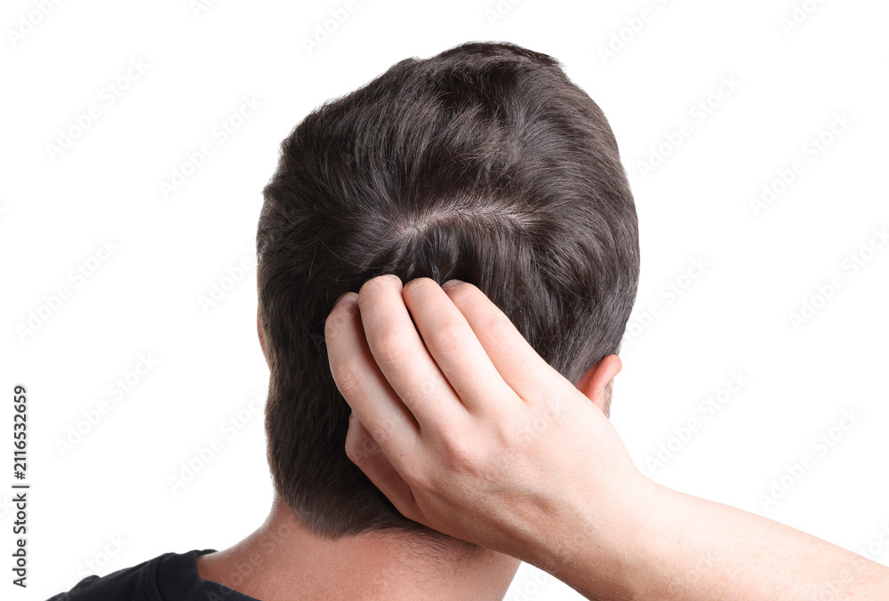 Fototapeta premium Man with hair loss problem on white background, closeup