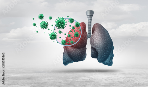 Foto Pneumonia outbreak concept showing a contagious respiratory infection spreading