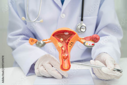 Obraz na plátně Doctor holding human uterus model for vaginal and cervix pap smear check up in the obstetrics and gynecology