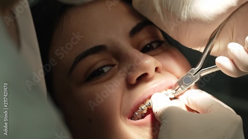 Orthodontist adjusting dental braces on patient