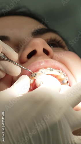 Orthodontist adjusting braces on female patient's teeth