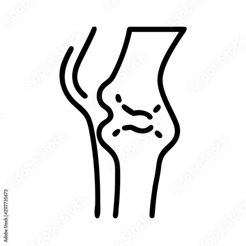 Joint inflammation and bone wear line icon for arthritis illustration.