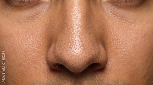 Extreme Macro Close Up of Male Nose Showing Oily Skin, Large Pores and Sebaceous Filaments