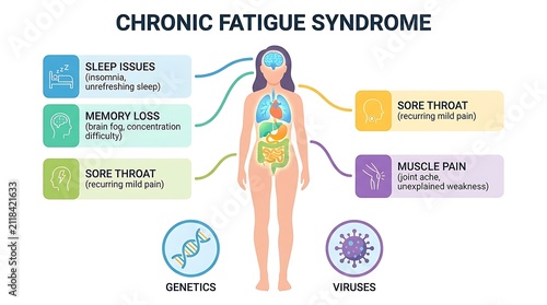 Chronic fatigue syndrome symptoms infographic medical diagram for patient