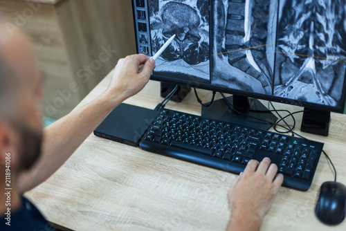 Photography A doctor analyzing a spine MRI scan on a computer screen in a clinic, pointing with a pen at a vertebral hernia or disc pathology during a medical examination and diagnosis process