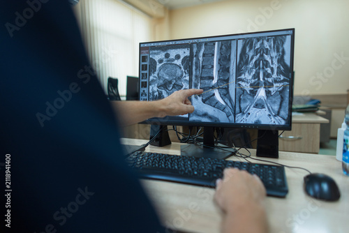Konstfotografi Medical professional analyzing a spine MRI scan on a computer screen in a hospital, pointing at a lumbar disc hernia during a diagnostic examination for back pain