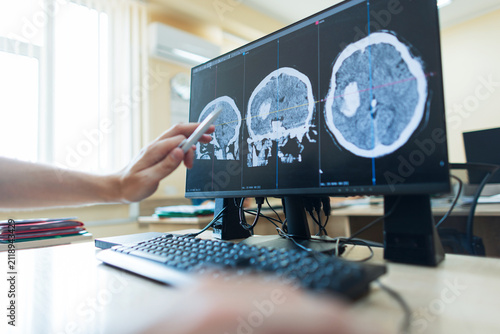 Картината върху платно professional neurosurgeon is working at a computer