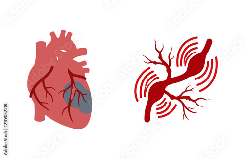 фотографія Medical illustration of heart disease with ischemia and atherosclerosis cardiova