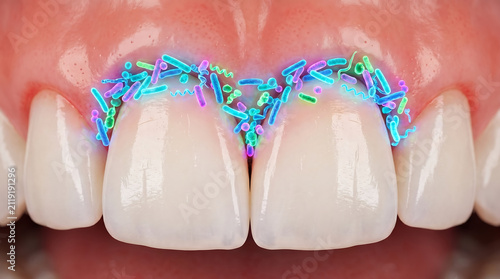 Dental plaque bacteria visualization on human teeth surface for oral health awareness with bacteria dentistry microscopic treatment clinical microbiology infection prevention