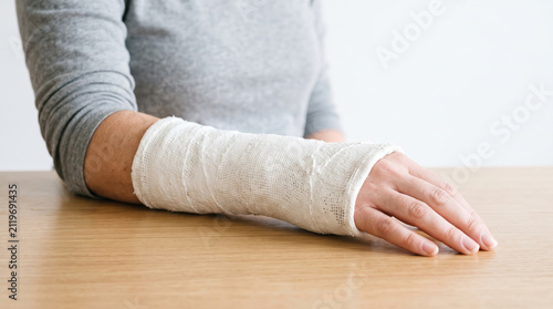 a women arm in a white plaster cast, hand resting on a clean table