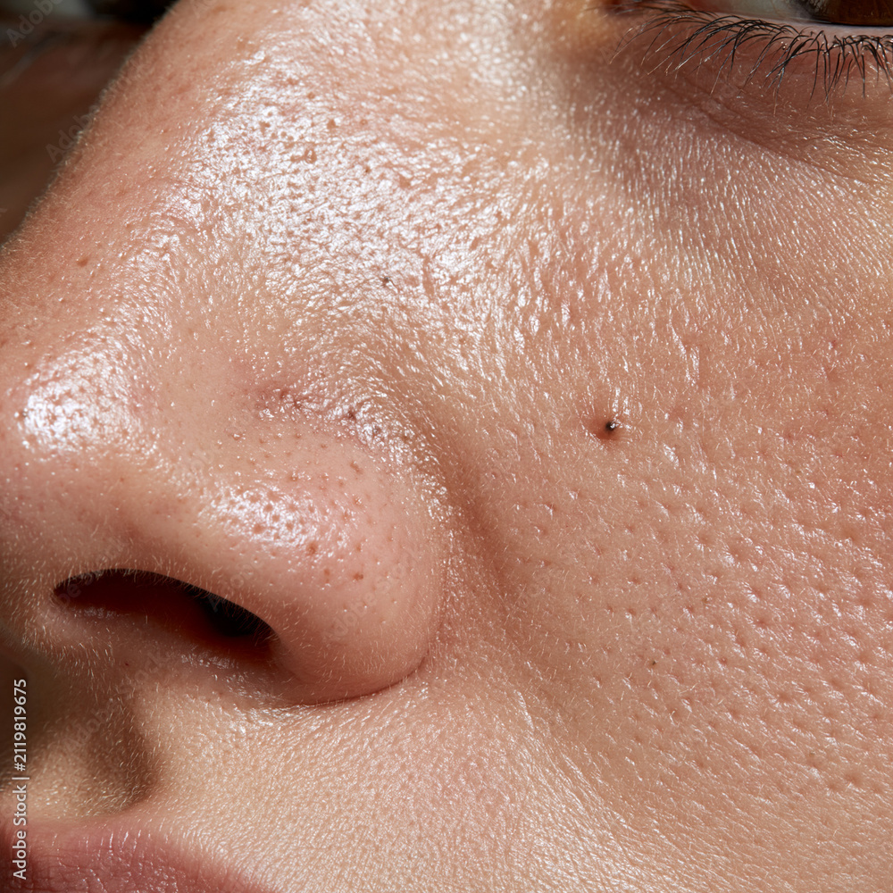 Fototapeta premium Macro close up of oily nose skin with enlarged pores and blackheads